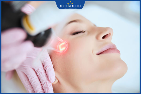 tổng quan về laser co2 fractional