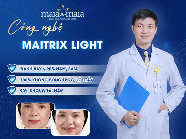 công nghệ maitrix light tại maia