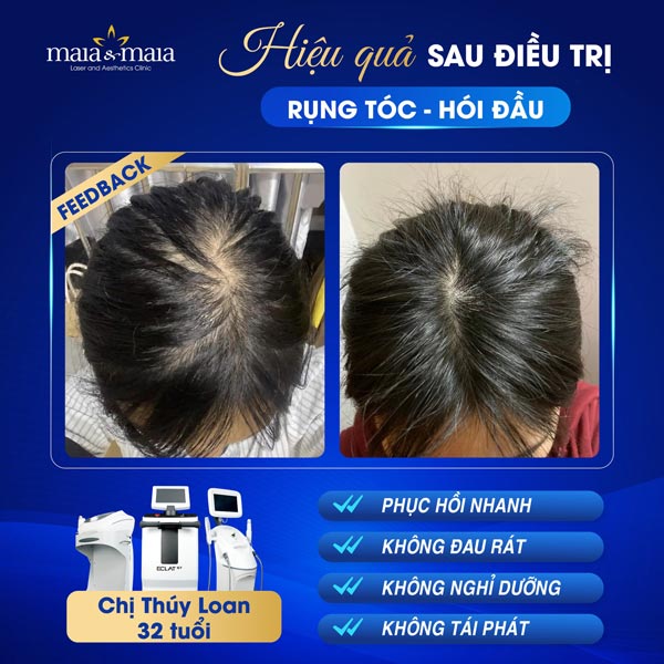 khách điều trị tóc