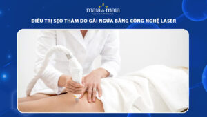 sẹo thâm do gãi ngứa