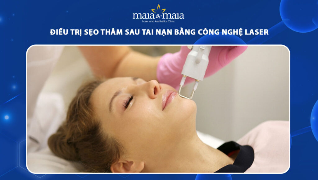 sẹo thâm sau tai nạn