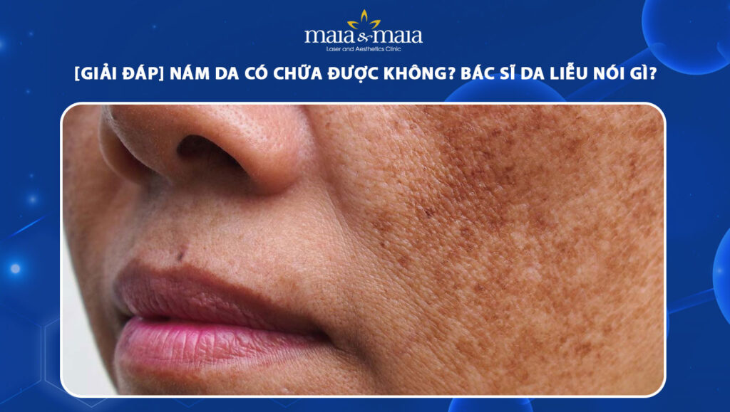 nám da có chữa được không