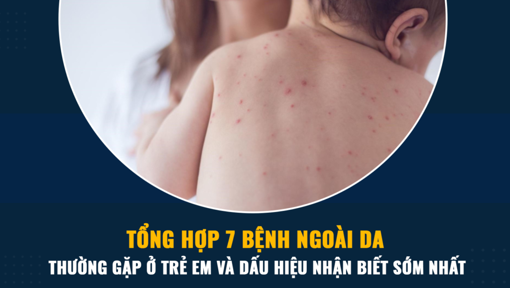 Tổng hợp 7 bệnh ngoài da thường gặp ở trẻ em và dấu hiệu nhận biết sớm nhất 1 7.........