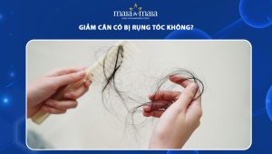 giảm cân có bị rụng tóc không