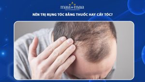 nên trị rụng tóc bằng thuốc hay cấy tóc
