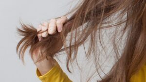 Ăn uống và giảm cân không hợp lý khiến tóc bị rụng