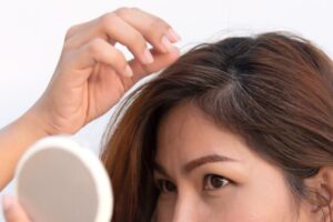 Nang tóc bị suy yếu cũng là lý do khiến tóc mọc chậm hơn