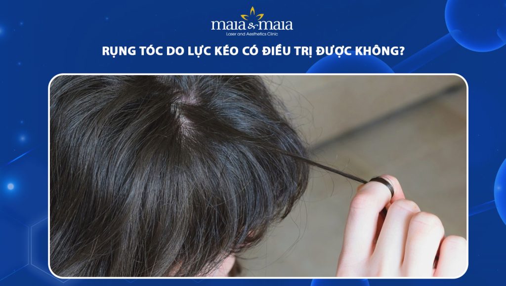 rụng tóc do lực kéo có điều trị được không