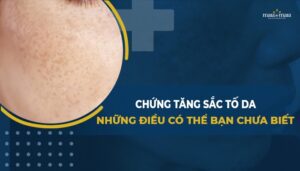 tang sac to 2