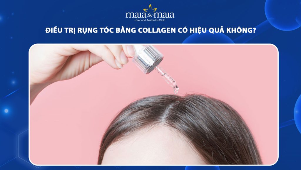 Điều trị rụng tóc bằng collagen có hiệu quả không? 1 điều trị rụng tóc bằng collagen có hiệu quả không