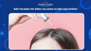 điều trị rụng tóc bằng collagen có hiệu quả không