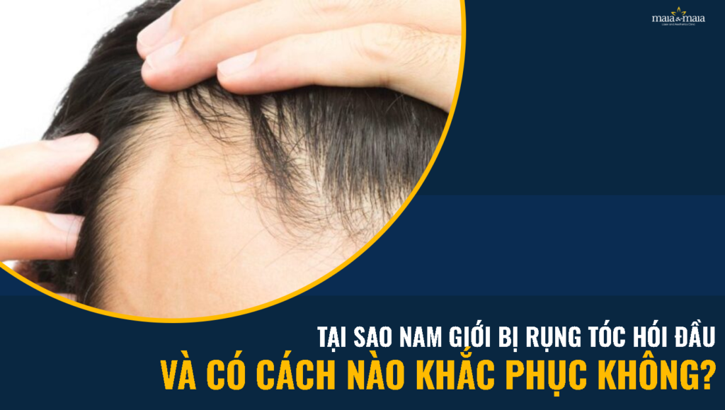Rụng tóc nhiều Nguyên nhân Dấu hiệu phân loại và chẩn đoán