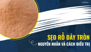 seo ro day tron