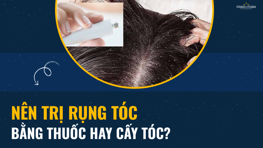 Thuốc Hair Tonic - chống rụng tóc, hói đầu, kích thích mọc tóc