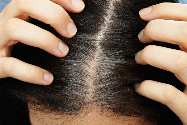 Điều trị rụng tóc bằng collagen cần sử dụng đúng liều lượng theo chỉ dẫn bác sĩ