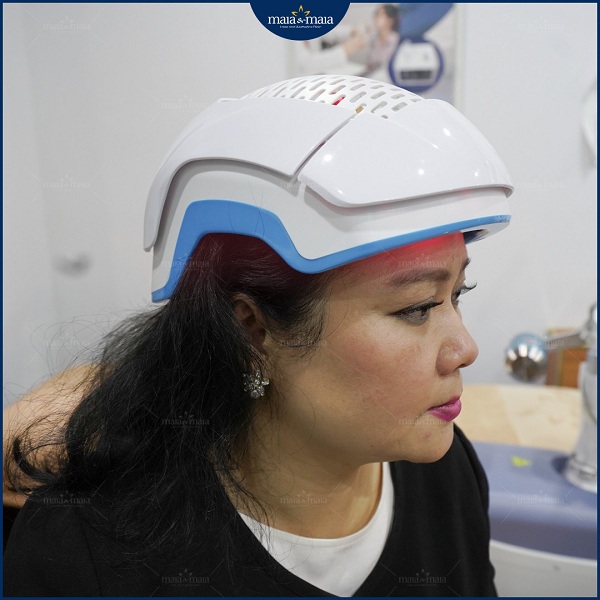 Công nghệ Meso hỗ trợ điều trị rụng tóc tại phòng khám Maia&Maia