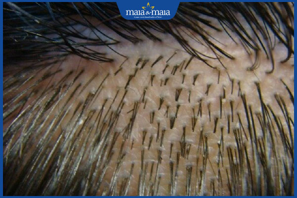 chức năng của nang tóc