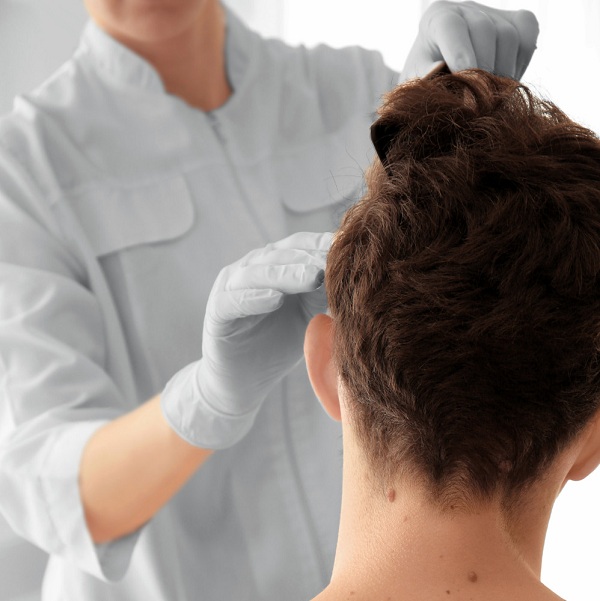Có khá nhiều phương pháp đang được ứng dụng trong điều trị rụng tóc hiện nay