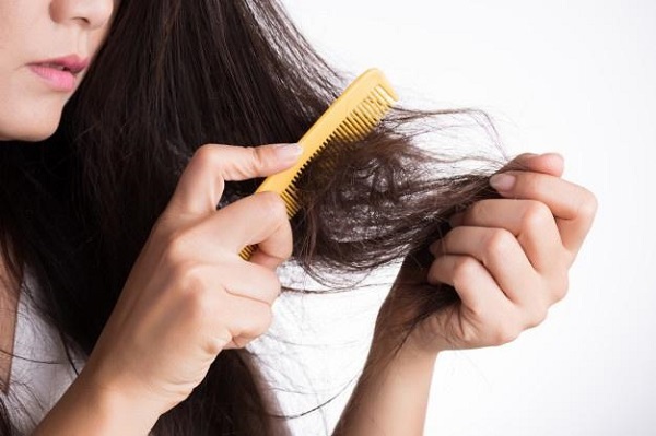 Điều trị rụng tóc bằng Rogaine có thể khiến tóc rụng nhiều hơn trong những tuần đầu