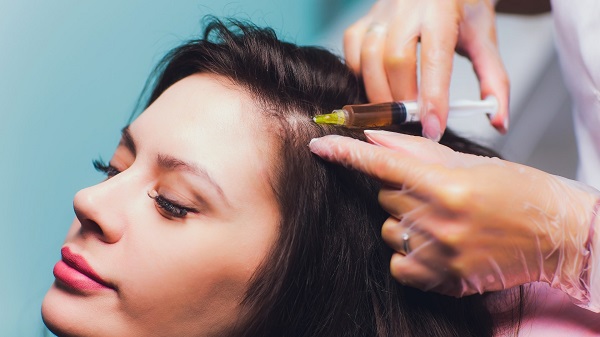 Hỗ trợ điều trị rụng tóc, kích thích mọc tóc bằng PRP