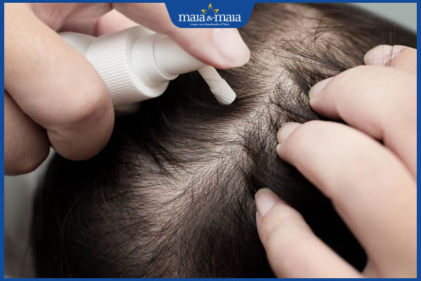 xịt thuốc trị rụng tóc