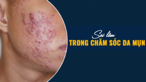 sai lam trong cham soc da mun 1