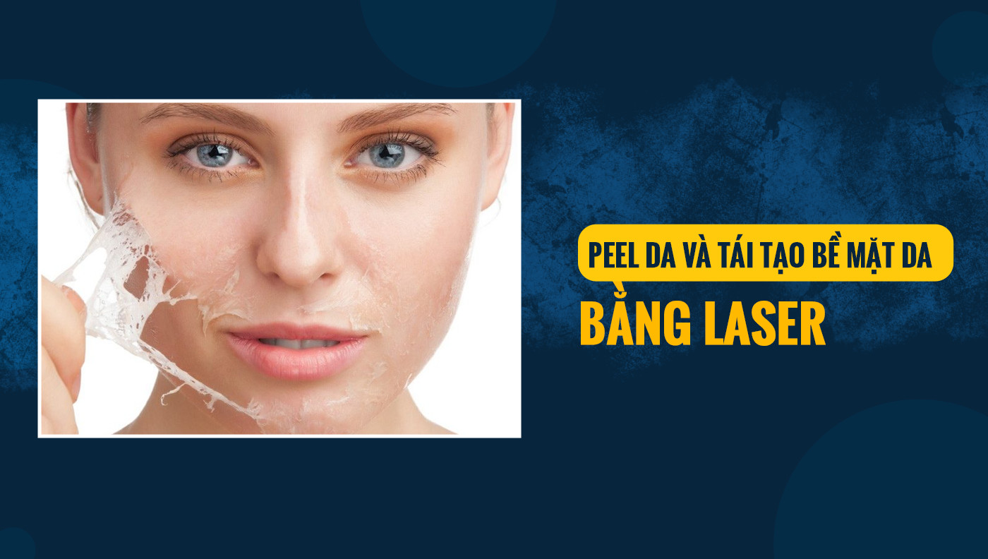 So sánh hai phương pháp thẩm mỹ: Peel da và laser - Phòng khám Maia