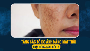 tang sac to tren da 4