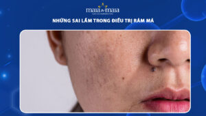 những sai lầm trong điều trị rám má