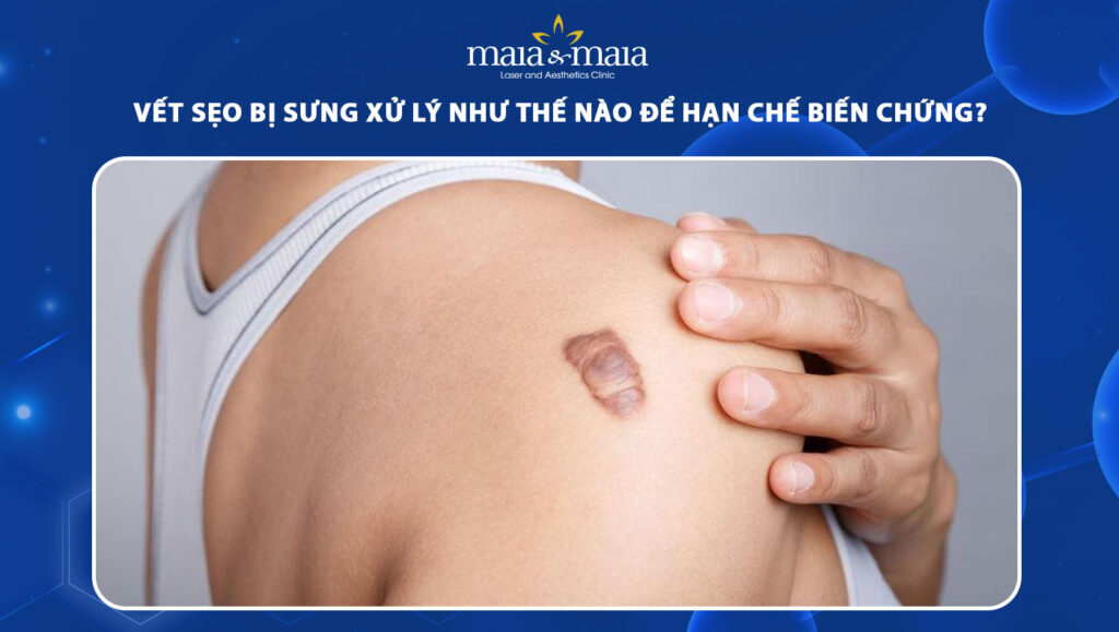 vết sẹo bị sưng