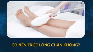 Có nên triệt lông chân không