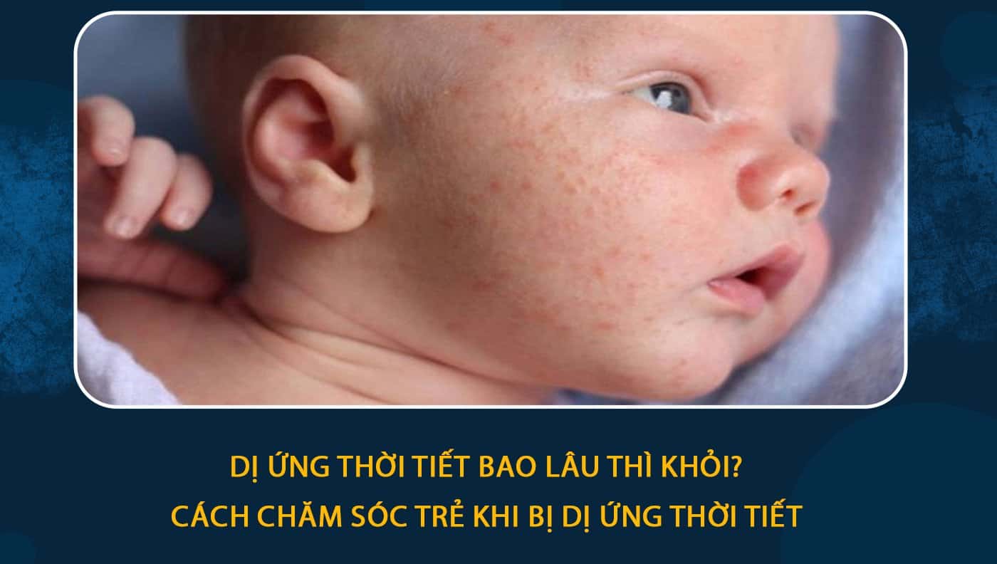 Kết luận