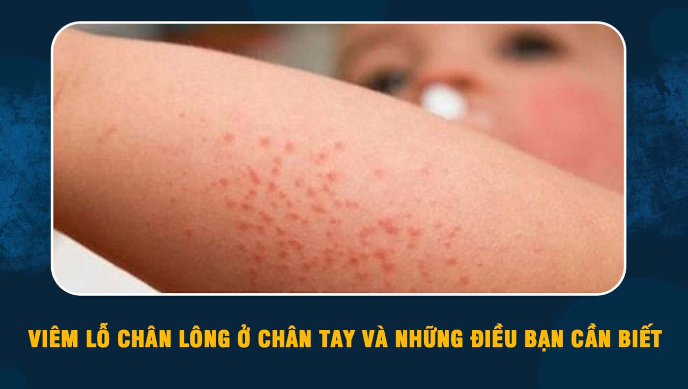 Da bị dị ứng, nổi mẩn đỏ – Phải làm sao? - Stamford Skin Centre