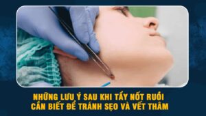 lưu ý sau khi tẩy nốt ruồi