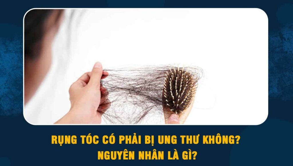 Rụng tóc có phải bị ung thư