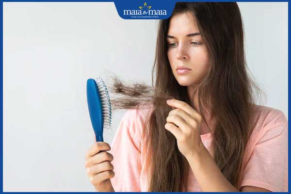 rụng tóc ở người trẻ tuổi