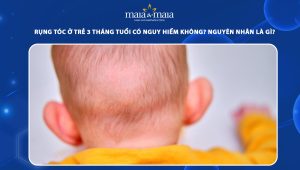rụng tóc ở trẻ 3 tháng tuổi có nguy hiểm không nguyên nhân là gì