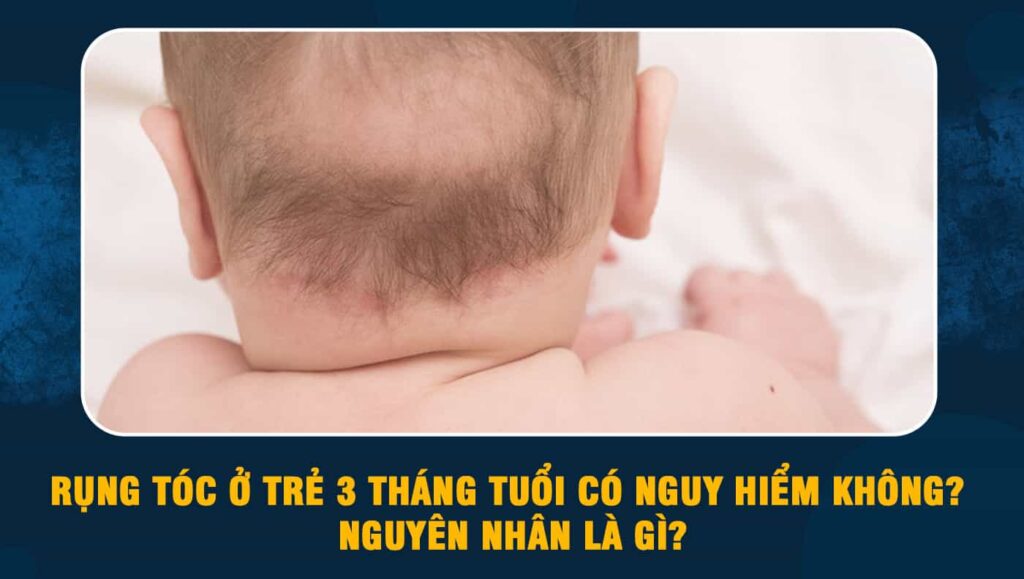 Rụng tóc ở trẻ 3 tháng tuổi