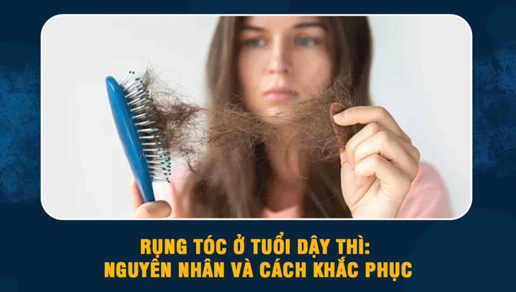 Nguyên nhân rụng tóc và cách chữa trị hiệu quả nhất hiện nay