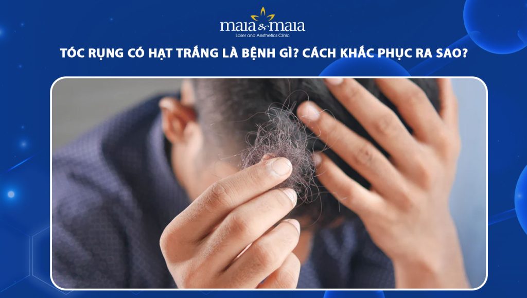 tóc rụng có hạt trắng là bệnh gì