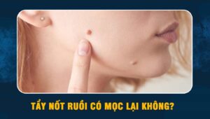 tẩy nốt ruồi có mọc lại không