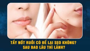 Tẩy nốt ruồi có để lại sẹo không