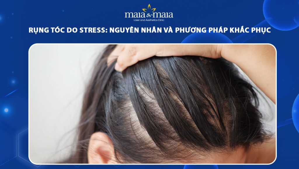rụng tóc do stress