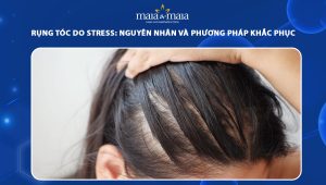 rụng tóc do stress