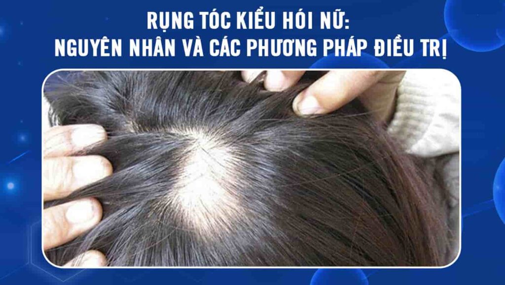 Hiện tượng trẻ dậy thì bị rụng tóc có nguy hiểm không