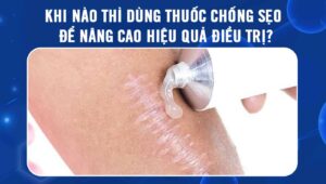 khi nào thì dùng thuốc chống sẹo