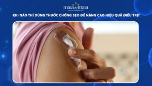 khi nào thì dùng thuốc chống sẹo