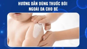 dùng thuốc bôi ngoài da cho bé