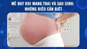 mề đay khi mang thai và sau sinh