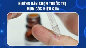 thuốc trị mụn cóc